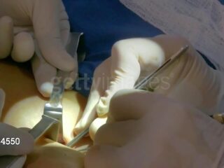 Aj lee fra wwe blir henne tredje bryst implant: gratis skitten video 8e